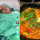 Doyan Makanan Ber-MSG Kelewatan, Wanita Ini Idap Tumor dan Harus Operasi