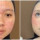 Transformasi Makeup Wanita Kulit Berjerawat Menjadi Flawless dan Mulus secara Otomatis, Menghasilkan Perubahan yang Signifikan