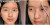 Makeup Cewek: Transformasi Wajah Berjerawat Menjadi Flawless ala Seleb Korea